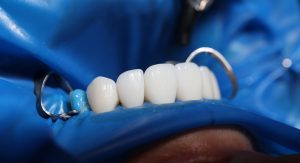 Dentalcare of Forrestfield